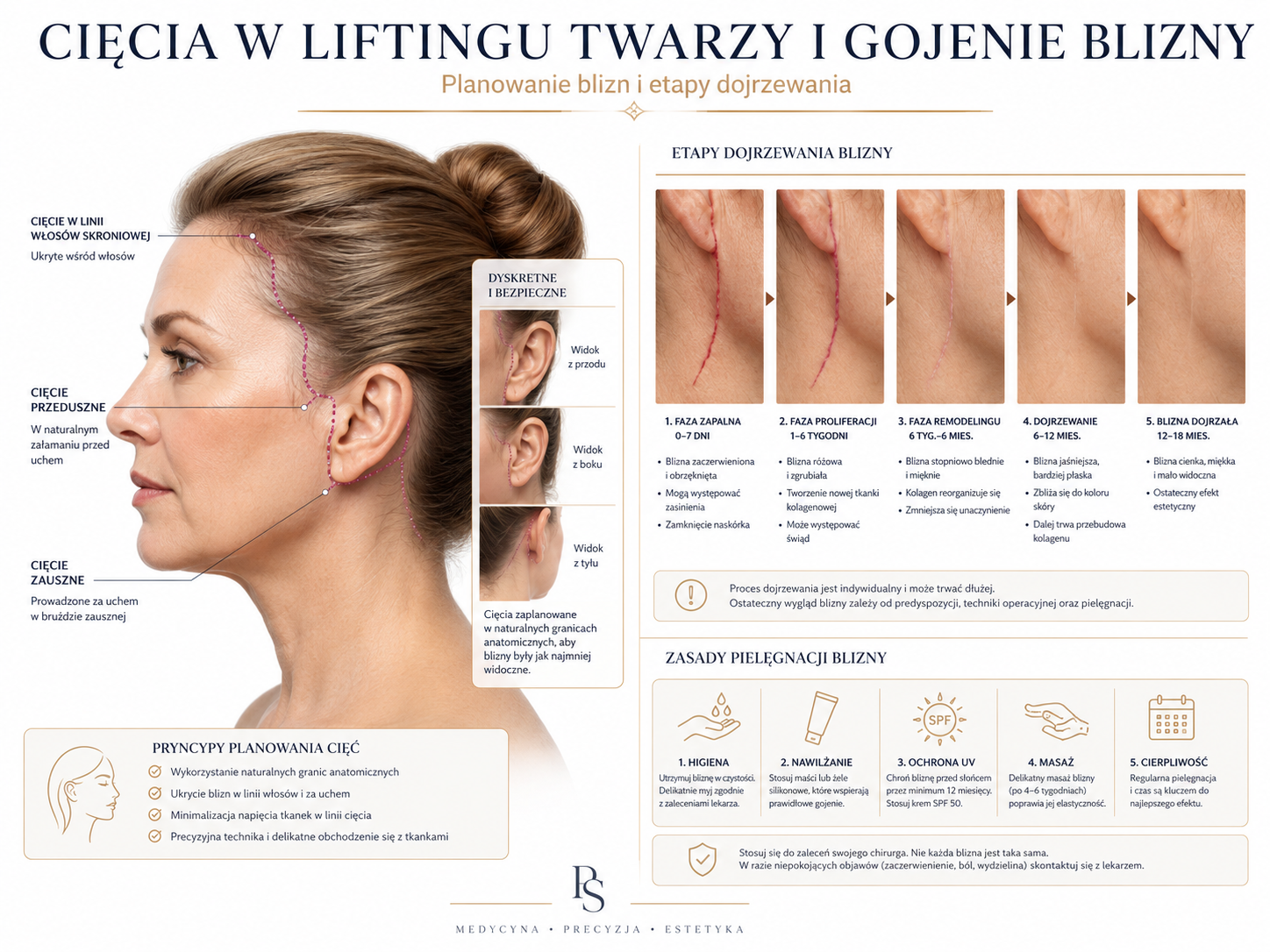 Profesjonalna ilustracja cięć i gojenia blizny po liftingu